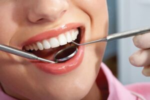Five Things to Look for When Choosing a Dentist - Taste For Health